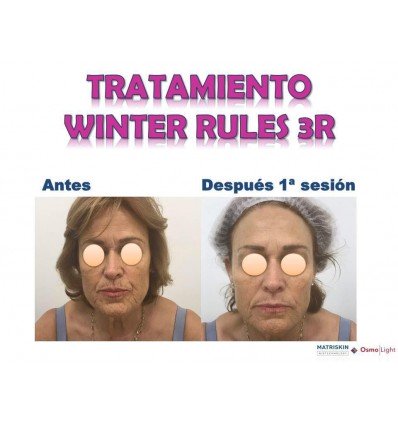tratamiento winter rules 3R