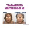 tratamiento winter rules 3R